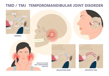 TMD-treatment